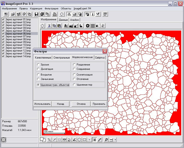 Программное обеспечение для количественного анализа изображений NEXSYS ImageExpert Pro 3 и NEXSYS ImageExpert Sample 2
